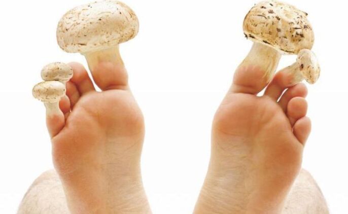 causas, sintomas e tratamento do fungo do pé