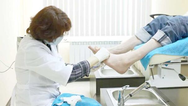 Um dermatologista trata fungos nas unhas dos pés